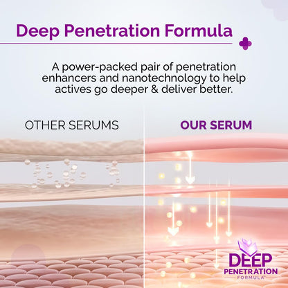 The Derma Co 10% Niacinamide Serum with 2% Zinc, Powered by Deep Penetration Formula™ | Fades Acne Marks, Controls Oil & Reduces Dark Spots | 10 ml