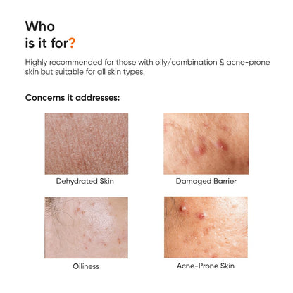 Minimalist Dehydrated Skin Moisturizer with 10% Vitamin B5 for Oily & Acne-Prone Skin | Oil-Free Hydration & Lightweight Gel Formula for Damaged Barrier Repair | Fast-Absorbing & Non-Sticky Lightweight Winter Cream | 50 grams