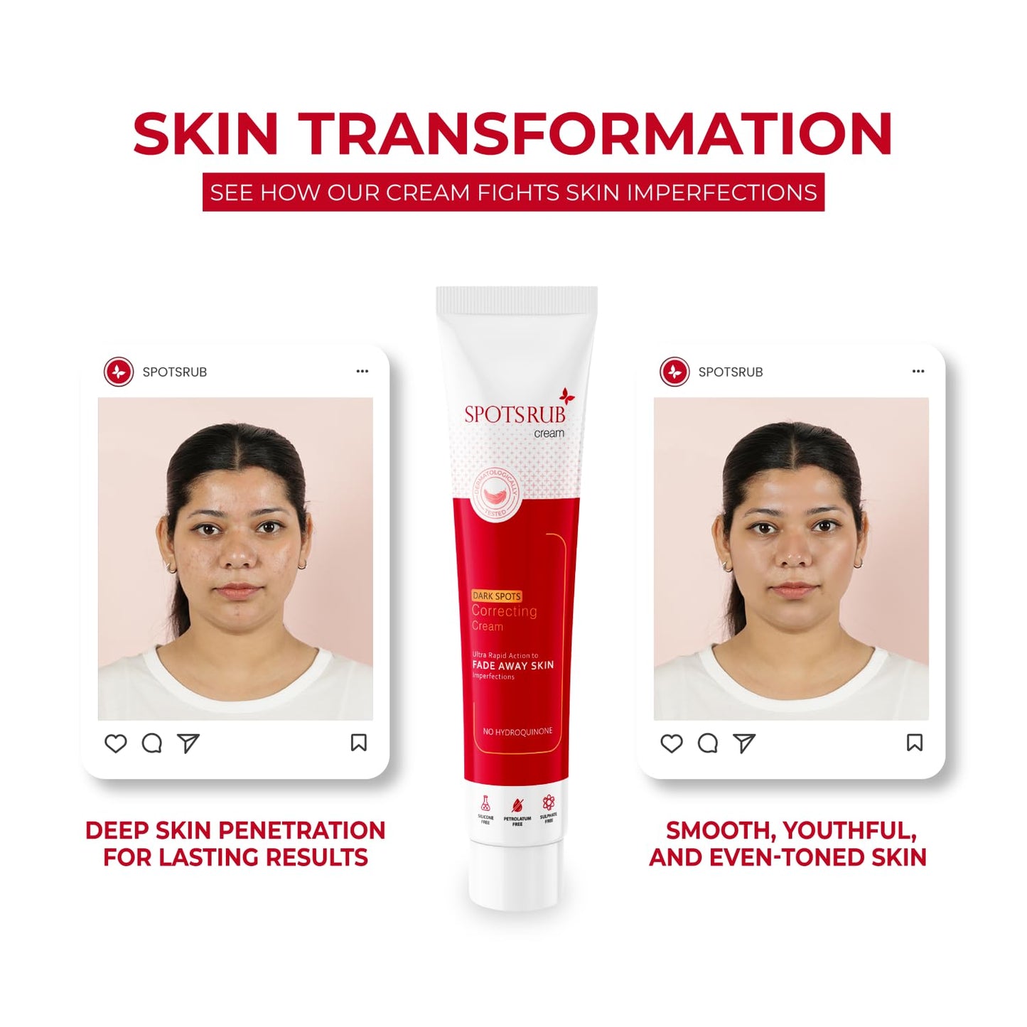 Leeford Spotsrub Face Cream for Women 15g - with 2% Kojic Acid and Vitamin C | Hydroquinone Free | Helps to Remove Pimples and Dark spots