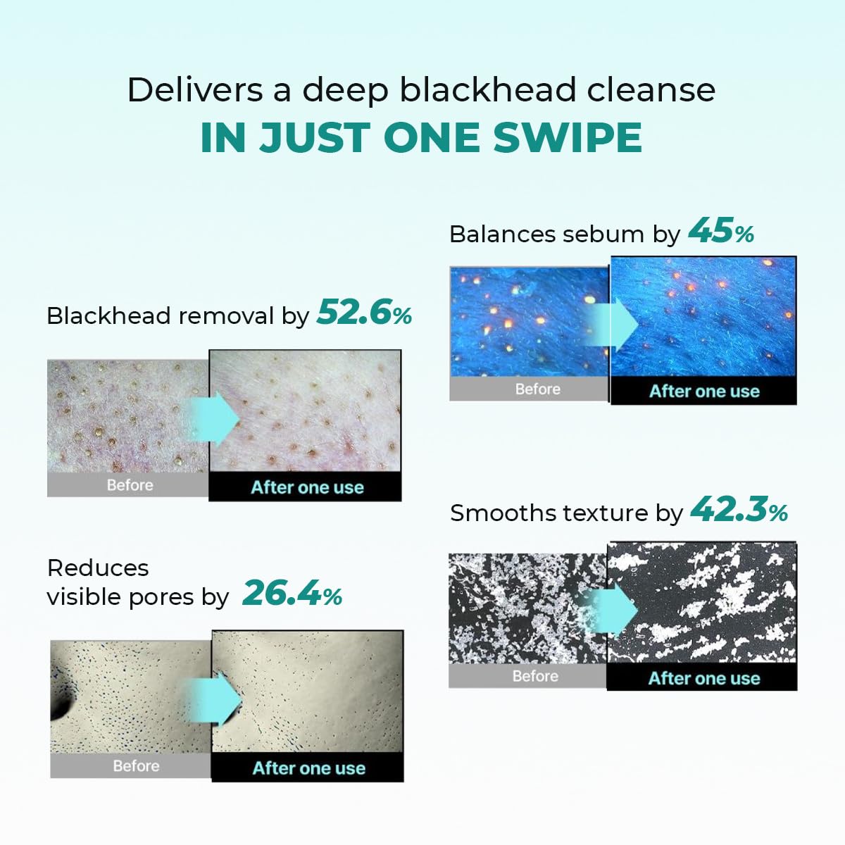 Product advertisement showing before and after effects with text about deep blackhead cleanse.