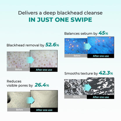 Product advertisement showing before and after effects with text about deep blackhead cleanse.