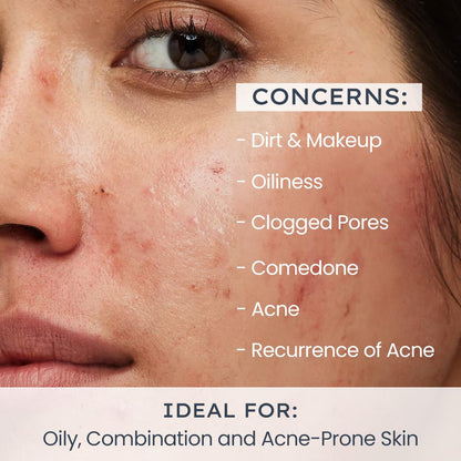Close-up of a person's face with skin concerns listed and text about ideal skin types.