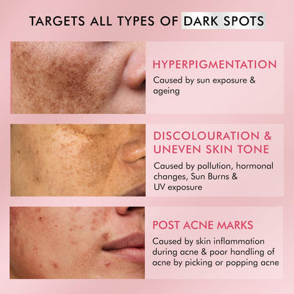 Product advertisement targeting dark spots on skin with hyperpigmentation, discolouration, and post-acne marks.