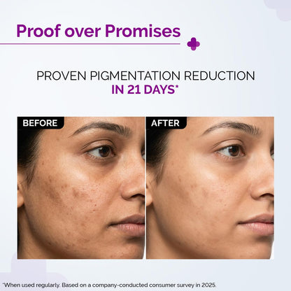 The Derma Co. 2% Kojic Acid Face Serum with Alpha Arbutin, Powered by Deep Penetration Formula™ | Fights Pigmentation | Fades Dark Spots | Brightens & Evens Skin Tone | 10 ml