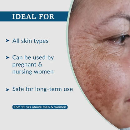 FCL AHA 10% Glycolic Acid Lightening Gel with 2% Alpha Arbutin | AHA Gel For Men & Women | Melasma Cream for All Skin Type | Paraben Free - 30ml