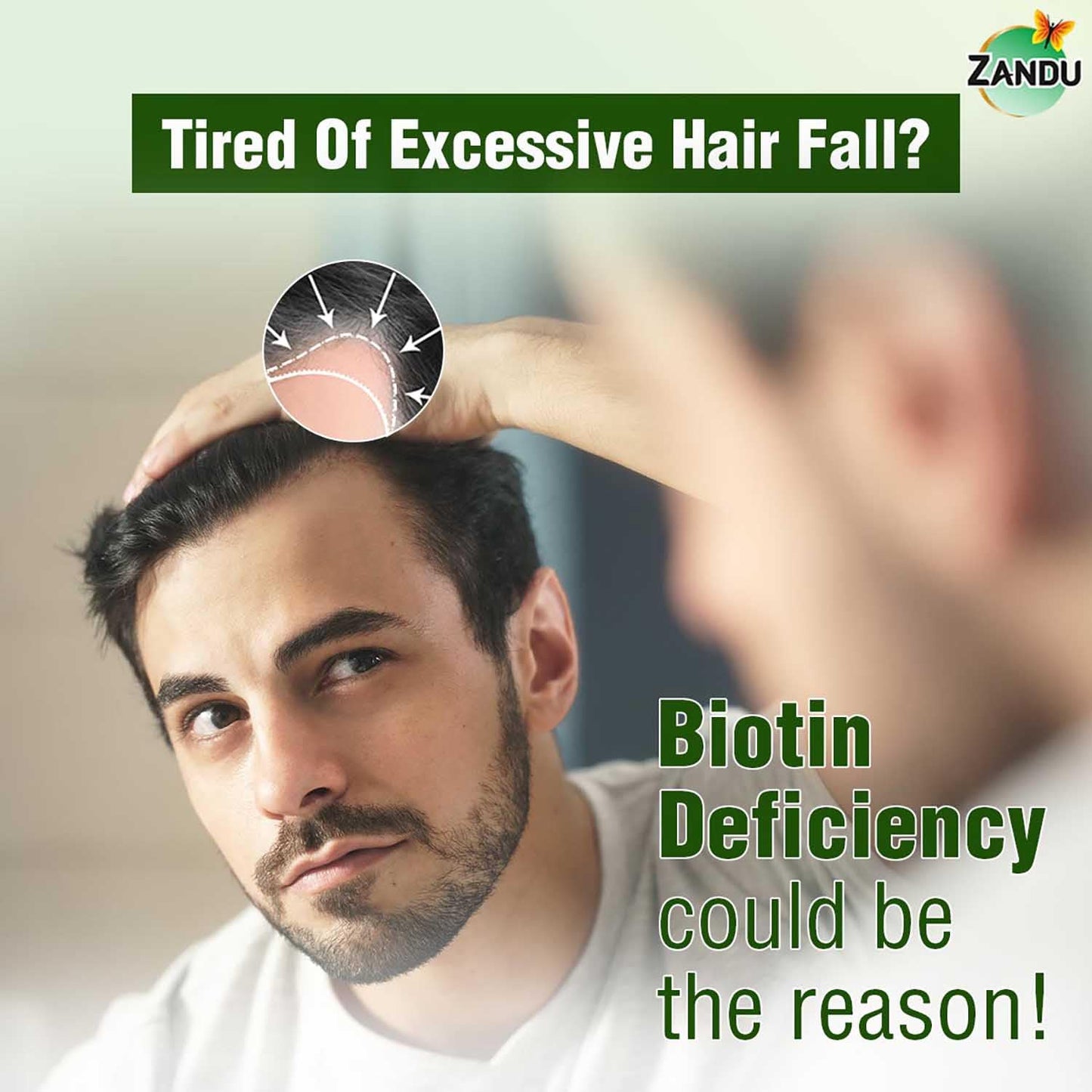 Zandu Plant Based Biotin Plus (200g)|10,000+mcg Biotin|Scientifically tested to Promote hair growth|Reduce Hairfall|100% Natural Sesbania|100% Ayurvedic | Gluten Free | No Harmful Chemicals, Powder