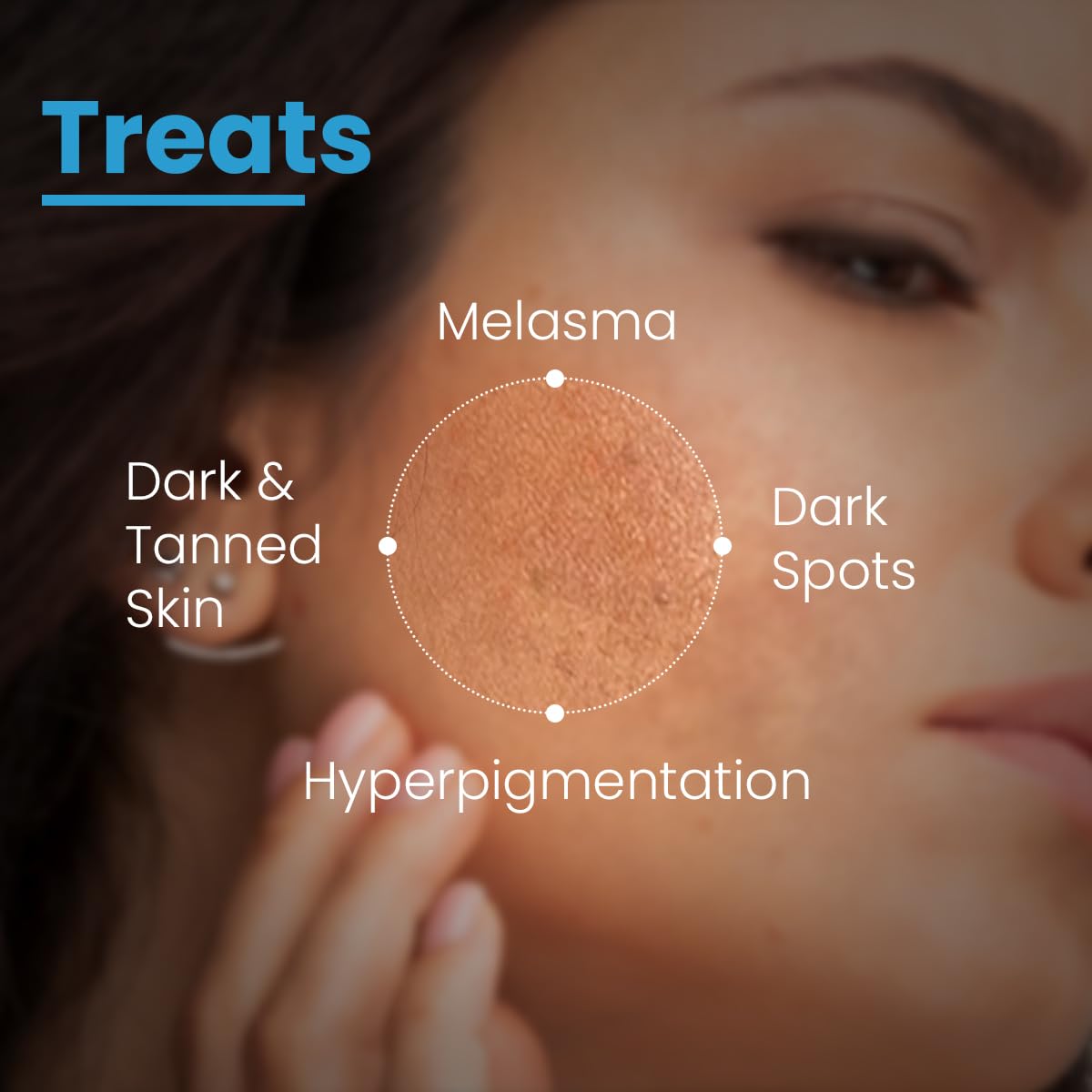 FCL AHA Lightening Gel | Glycolic Acid | Treats Hyperpigmentation, Dark spots, Tanned Skin, Reduce Dark Spots Age spots & freckles Uneven skin tone | Aha lightening gel 15 ml (Pack of 1)