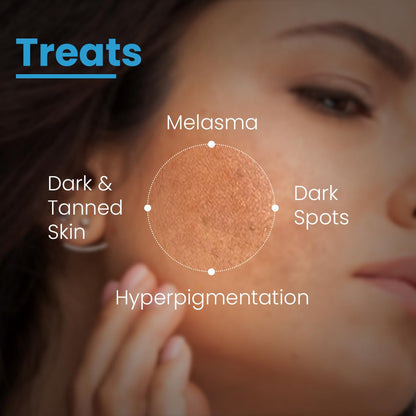 FCL AHA Lightening Gel | Glycolic Acid | Treats Hyperpigmentation, Dark spots, Tanned Skin, Reduce Dark Spots Age spots & freckles Uneven skin tone | Aha lightening gel 15 ml (Pack of 1)