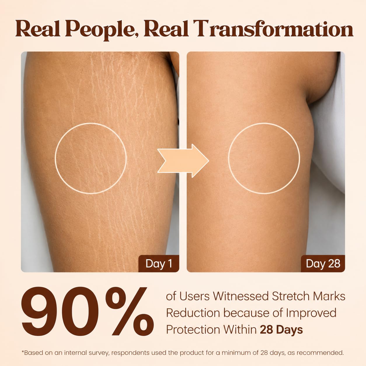 Pokonut Stretch Marks Cream for Women & Men | For Pregnancy, After Delivery & Weight Loss | Fades Old & New Marks on Belly, Thighs & Hips | Hyaluronic Acid + Rosehip Oil | Non-Sticky | 50g