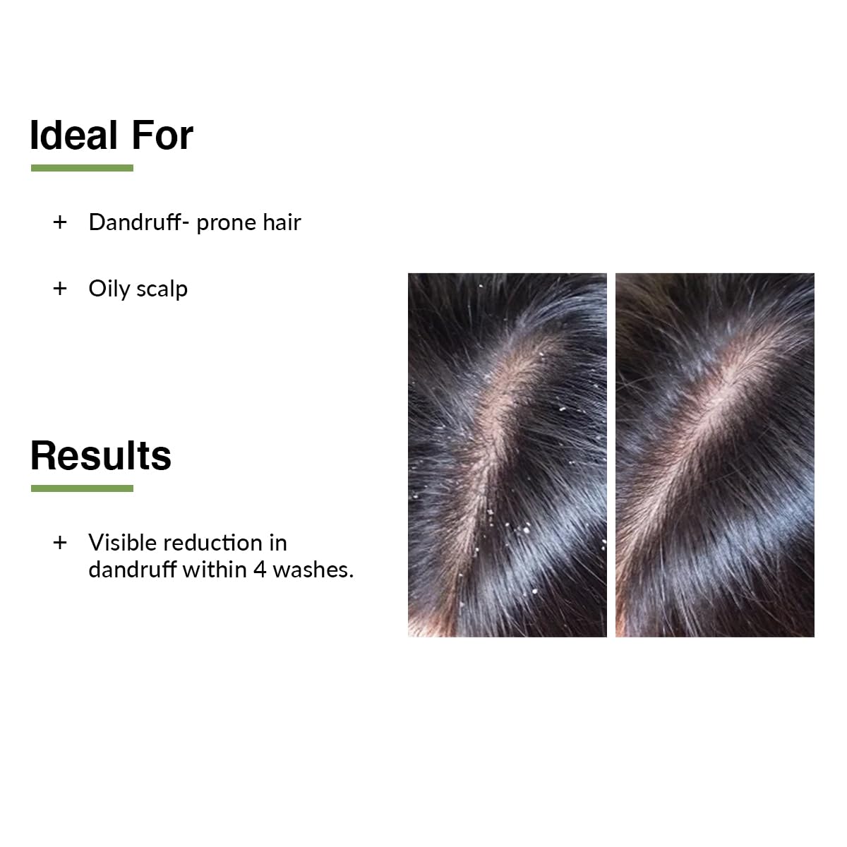 Fixderma Kairfoll Anti Dandruff Shampoo for Oily Sensitive Scalp Prone to Dandruff & Folliculitis | Anti Dandruff Shampoo for Women & Men | 2% w/w Salicylic Acid for Hair Fall Shampoo - 15 ml