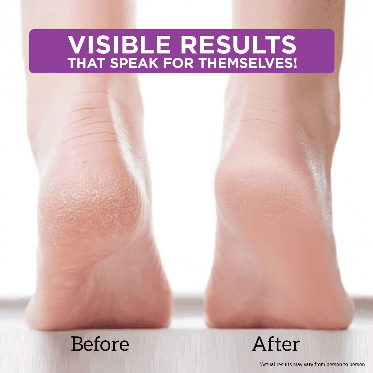 HeelRepair Cream with Herbal Extracts | Helps Soften Dry, Scaly & Cracked Heels | Nourishing Foot Care Formula for Smooth, Hydrated Skin | 15g