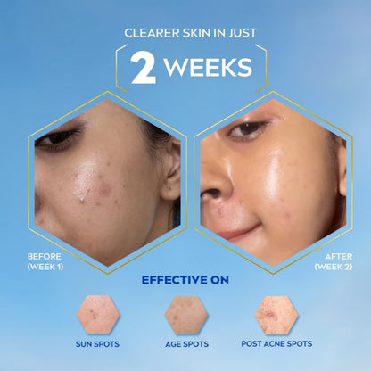 NIVEA Luminous Even Glow Oil Control Day Cream & Moisturizer For Face,Spf 50 With Uv Protection&UVA UVB Filters,Thiamidol,Hyaluronic Acid,Vitamin E For Dark Spots Reduction&Deep Moisturization,40Ml