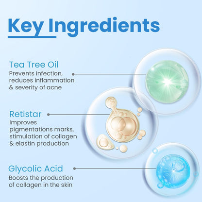 FCL Alpha Beta Acne Gel | Adapalene Gel 01 Acne Treatment | Glycolic Acid | Treats Open Pores Suitable For All Skin Types Paraben Free- 30ml