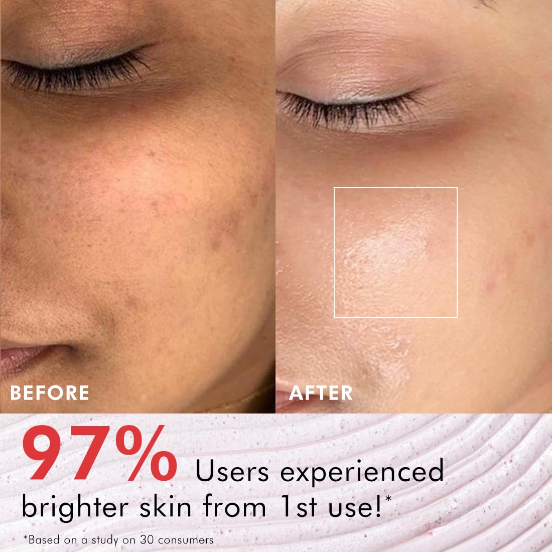 Before and after comparison of skin with a focus on a blemish, featuring text about user experience with a skincare product.