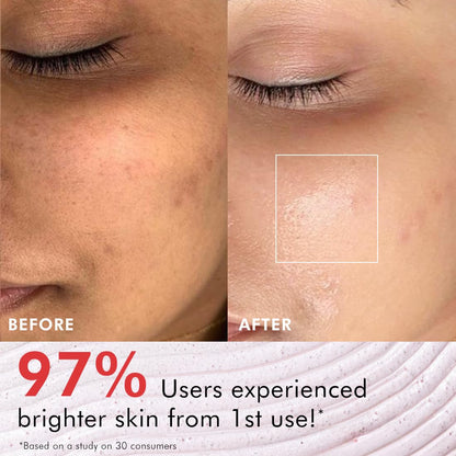 Before and after comparison of skin with a focus on a blemish, featuring text about user experience with a skincare product.