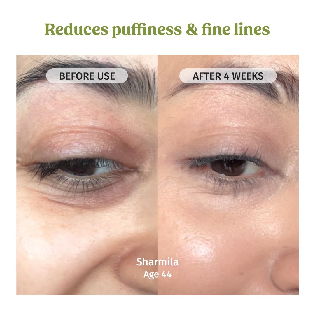 Vilvah Under Eye Cream | Reduces Dark Circles, Puffiness & Eye Bags | Hydrates, Smoothens Fine Lines & Firms Skin | Lightweight Cream for Tired Eyes | 20ml