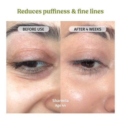 Vilvah Under Eye Cream | Reduces Dark Circles, Puffiness & Eye Bags | Hydrates, Smoothens Fine Lines & Firms Skin | Lightweight Cream for Tired Eyes | 20ml