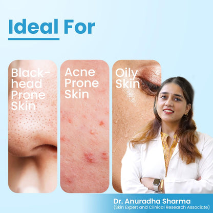 FCL Alpha Beta Acne Gel | Adapalene Gel 01 Acne Treatment | Glycolic Acid | Treats Open Pores Suitable For All Skin Types Paraben Free- 30ml
