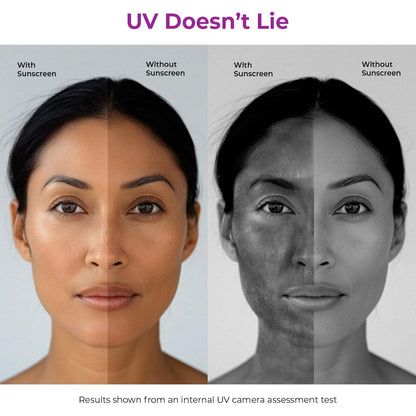 Comparison of a woman's face with and without sunscreen using UV assessment.