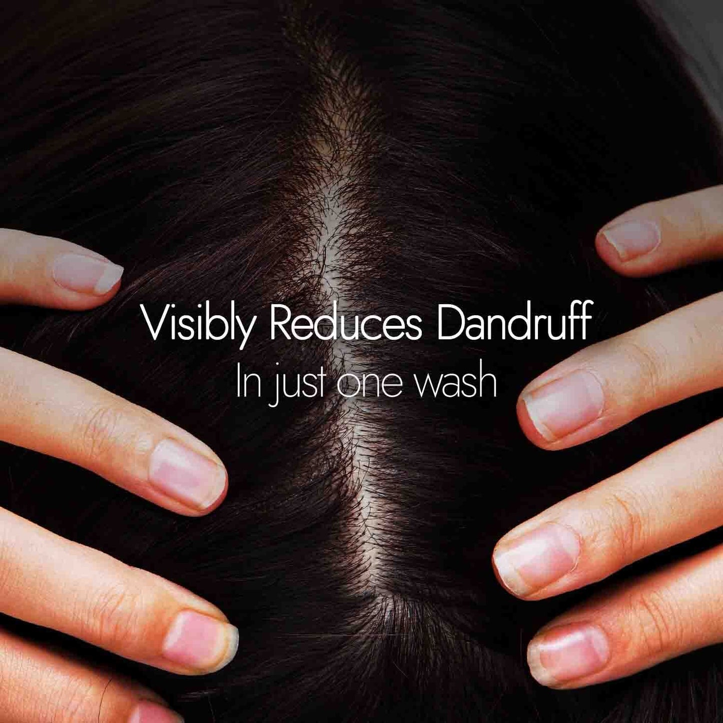Kapiva Dandruff Control Neem Triphaladi Shampoo | Helps to reduce mild to heavy dandruff in 1 month