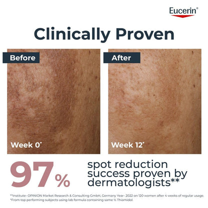 Eucerin Anti-Pigment Face Cream with Thiamidol & SPF 30, Reduces Dark Spots 50ml