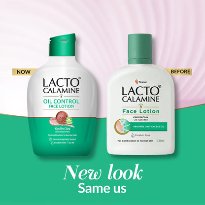 Lacto Calamine Face Lotion | 120ml | Daily Moisturizer For Face - Combination To Normal Skin | Kaolin Clay & Aloe Vera | Abosrbs Excess Oil | Fights Pimples, Darkspots & Blackheads | Body Lotion