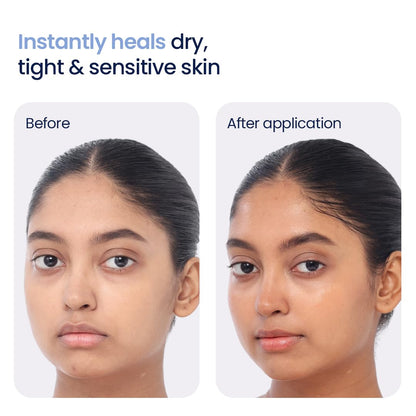 Before and after application of a skincare product on a person's face.
