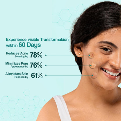 VENUSIA Dr. Reddy's Acne Control Moisturizer I For Oily & Acne Prone Skin I Prevents Acne Breakouts|Oil Free, Non Sticky I 75G