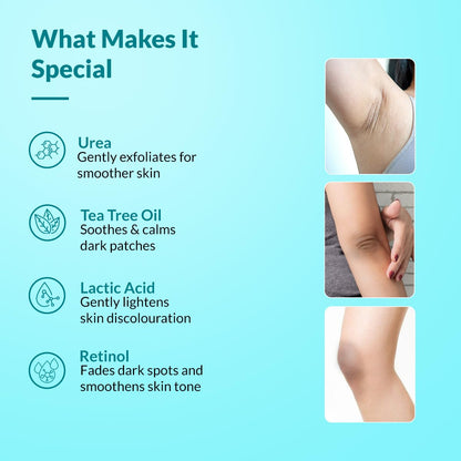 Fixderma Nigrifix Cream for Acanthosis Nigricans with Lactic Acid For Body Parts like Neck, Ankles, Knuckles, Armpits, Thighs & Elbows | Exfoliant 100 gm
