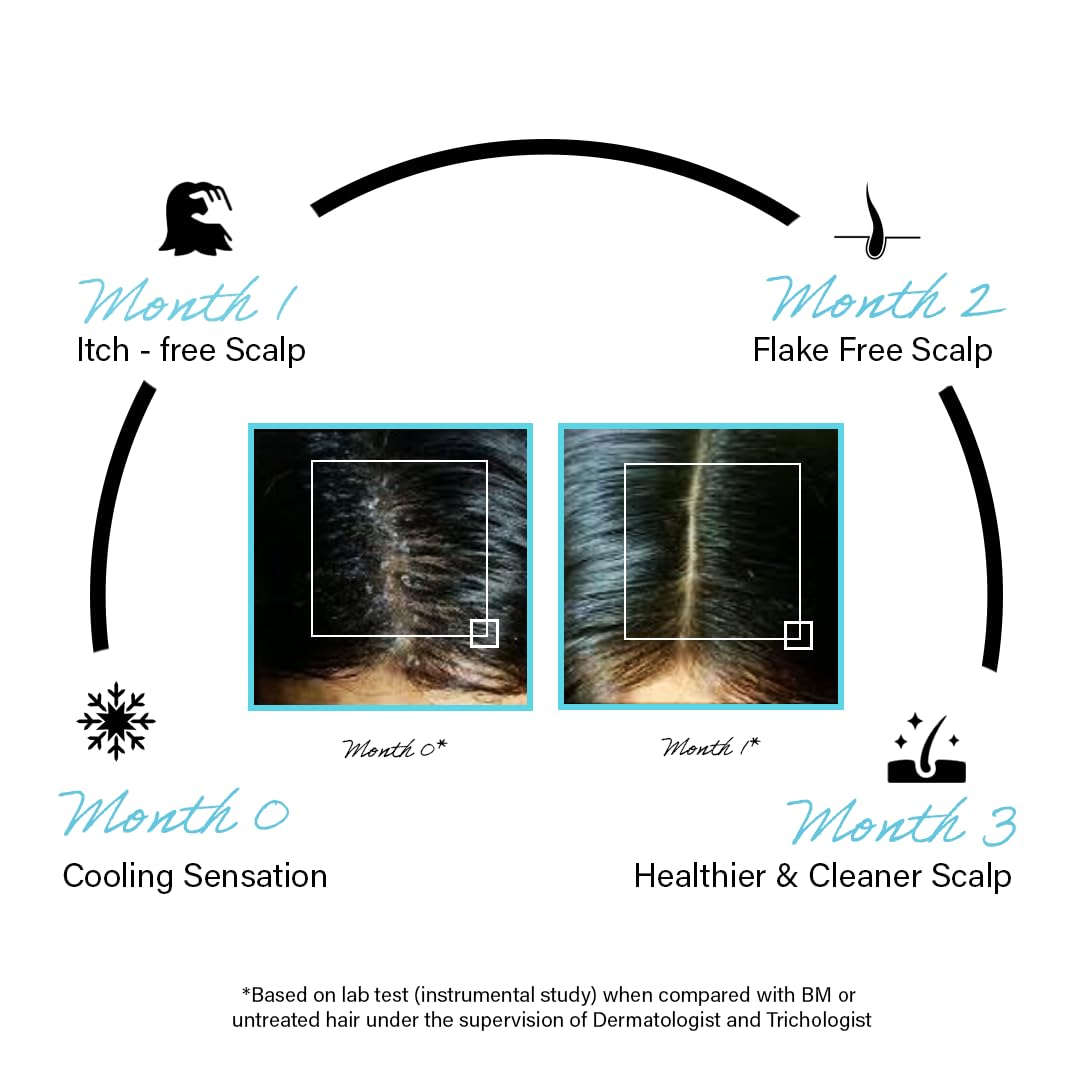 Diagram showing scalp health improvement over three months with visual before and after images.