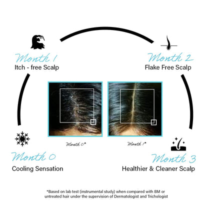 Diagram showing scalp health improvement over three months with visual before and after images.