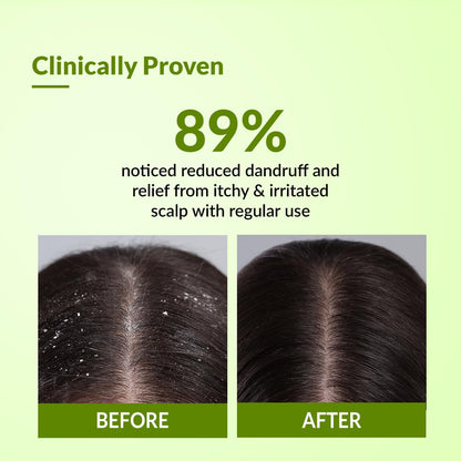 Fixderma Kairfoll Anti Dandruff Shampoo for Oily & Sensitive Prone Scalp | Piroctone Olamine & Salicylic Acid | Sulphate Free | Anti Fungal Shampoo for Women & Men - 100ml
