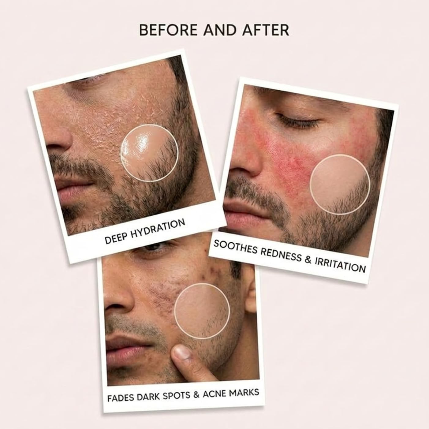 Soyaang Pure Centella Brightening Serum for Indian Men with Niacinamide, Madecassoside & 3X Hyaluronic Acid | Reduces Dark Spots, Redness & Uneven Skin Tone | For All Skin Types | 30ml