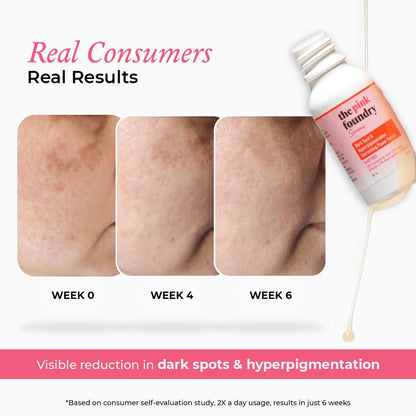 The Pink Foundry Dark Spot & Hyperpigmentation Serum with 3% Tranexamic Acid 2% Alpha Arbutin 3% Niacinamide | Fades Appearance of Acne Marks | All Skin Types | For Men & Women | Lightweight & Fast Absorbing | 15 ml