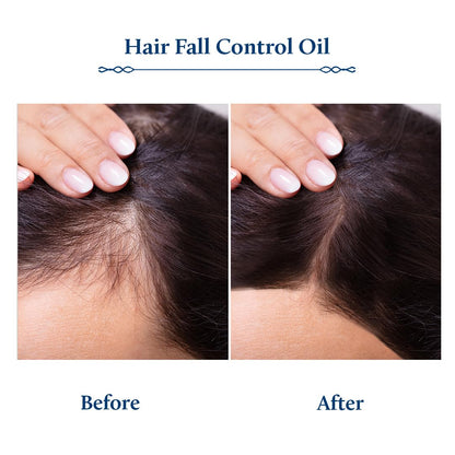 Blue Nectar Briganantadi Hair Oil with Bhringraj & Amla | Ayurvedic Non-Sticky hair oil for Hair growth & Healthy Scalp (10 Herbs, 200ml)