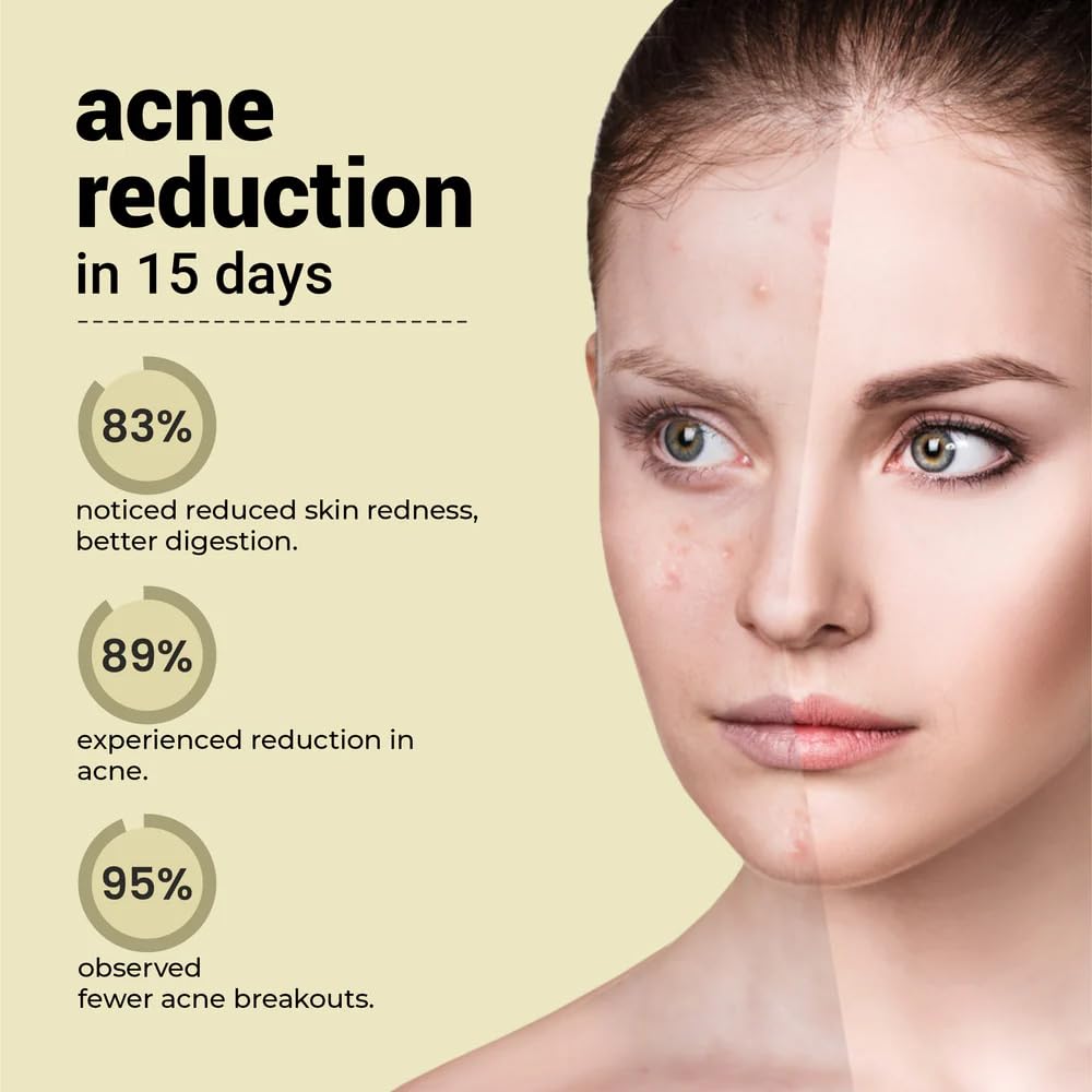 Before and after comparison of a person's face with acne reduction claims on a beige background