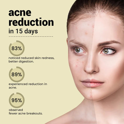 Before and after comparison of a person's face with acne reduction claims on a beige background