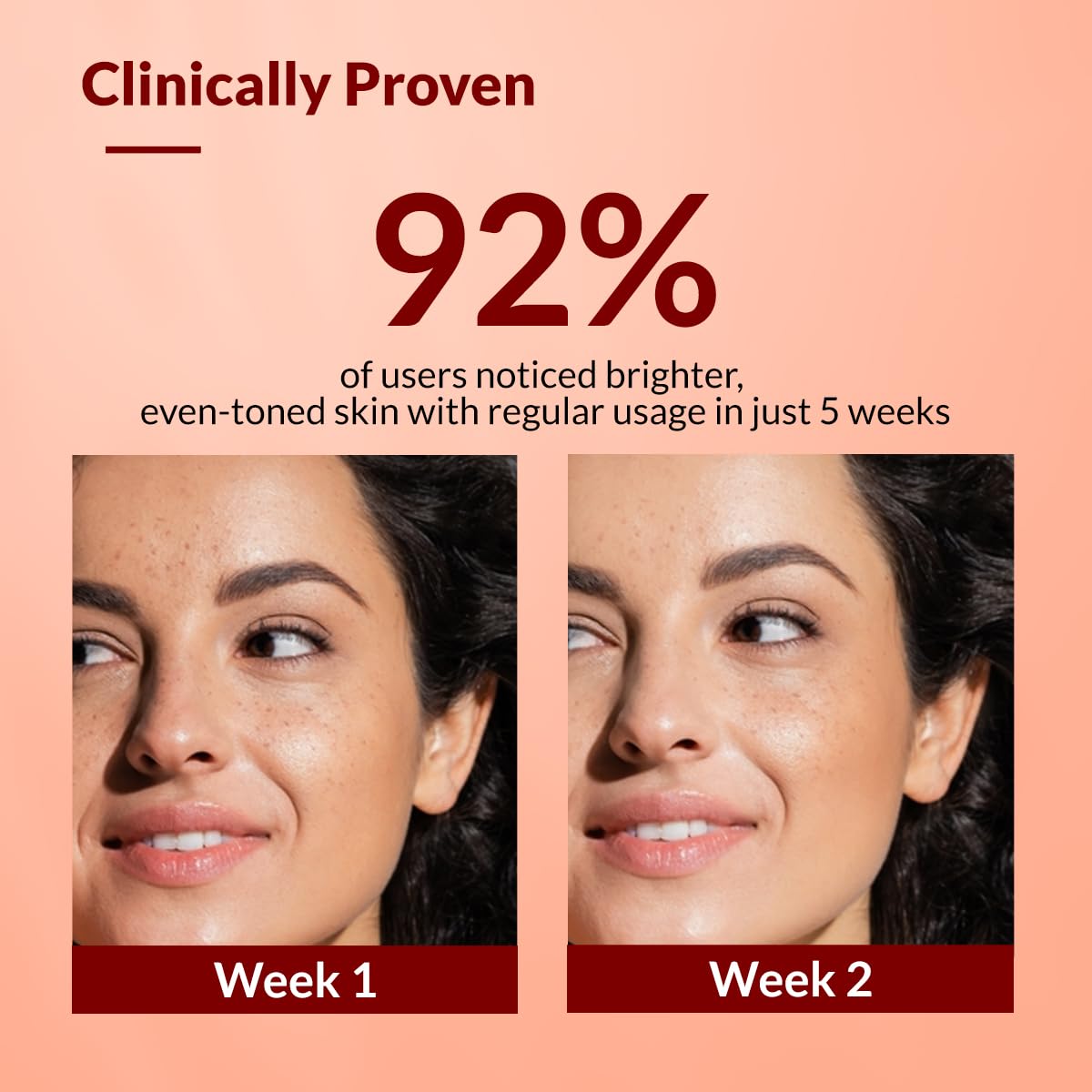 Fixderma Tranexamic Acid + 2% Kojic Acid + 1% Arbutin SKARFIX -TX Face Cream | Pigmentation Removal Cream | Kojic Acid Cream | Uneven Skin Tone - 30 gm