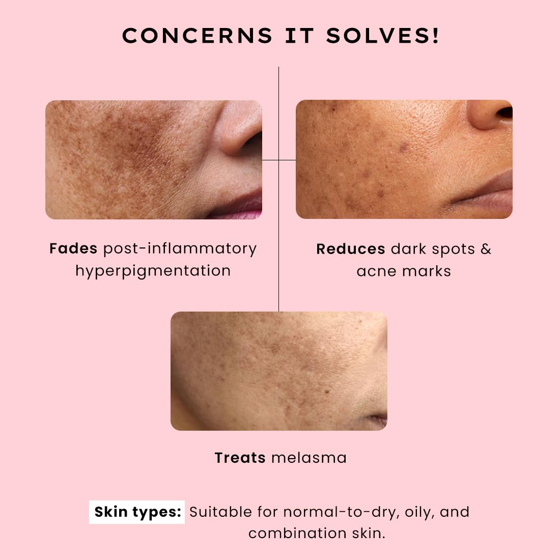 Product advertisement showing skin before and after use with text on a pink background