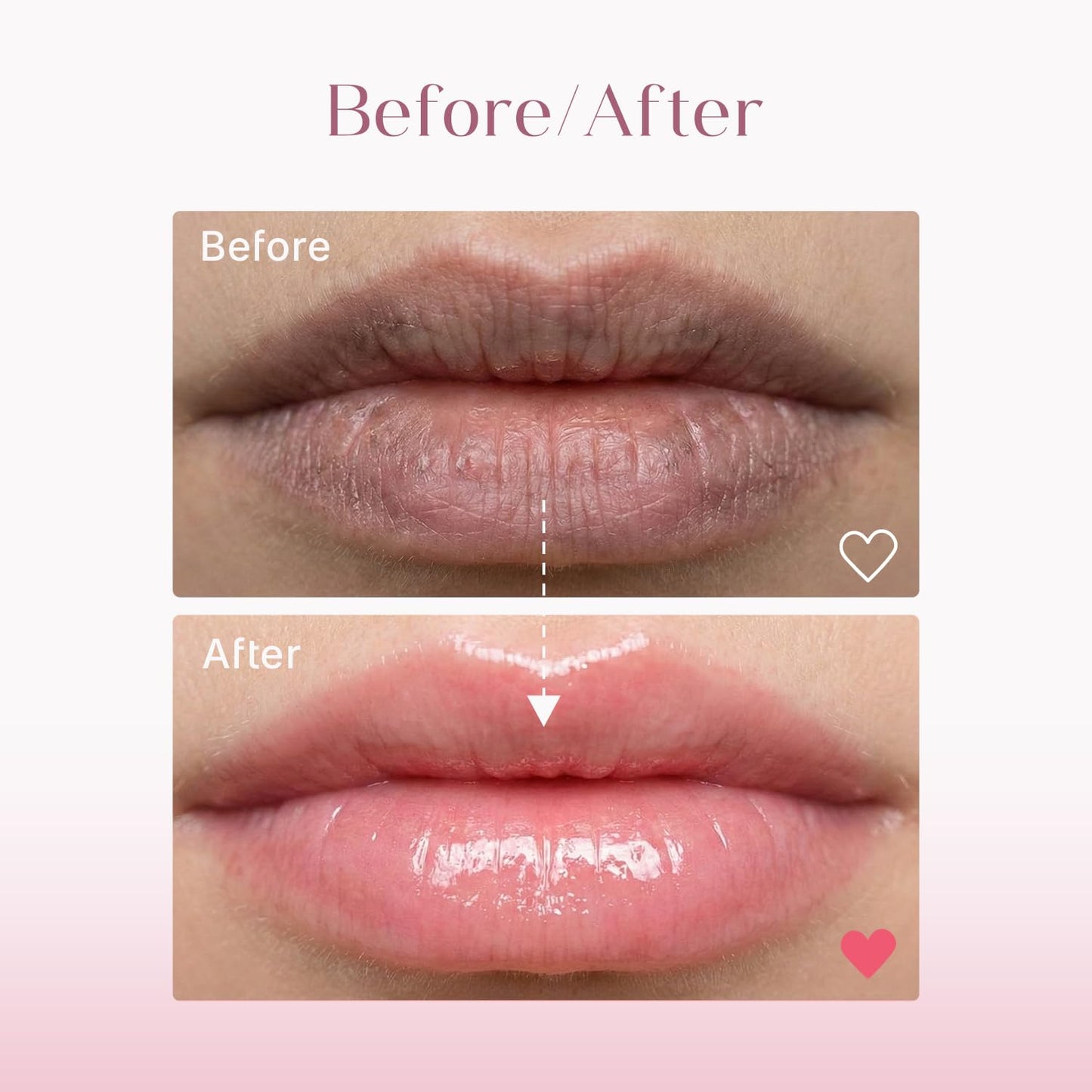 Seoulskin Brightening Lip Balm with SPF 50 PA++, Kojic Acid & Niacinamide | Brightening Lip Balm for Dark Lips | Repairs Chapped Lips | For Dark Lip Lightening & Protection | 10g