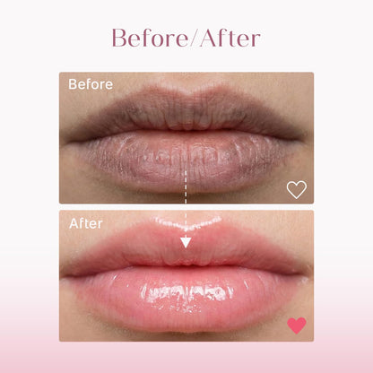 Seoulskin Brightening Lip Balm with SPF 50 PA++, Kojic Acid & Niacinamide | Brightening Lip Balm for Dark Lips | Repairs Chapped Lips | For Dark Lip Lightening & Protection | 10g