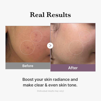 Medicube Age-R Glutathione Glow Milky Toner, Double Layer Korean Skincare, Peptide Formula for Radiant Skin