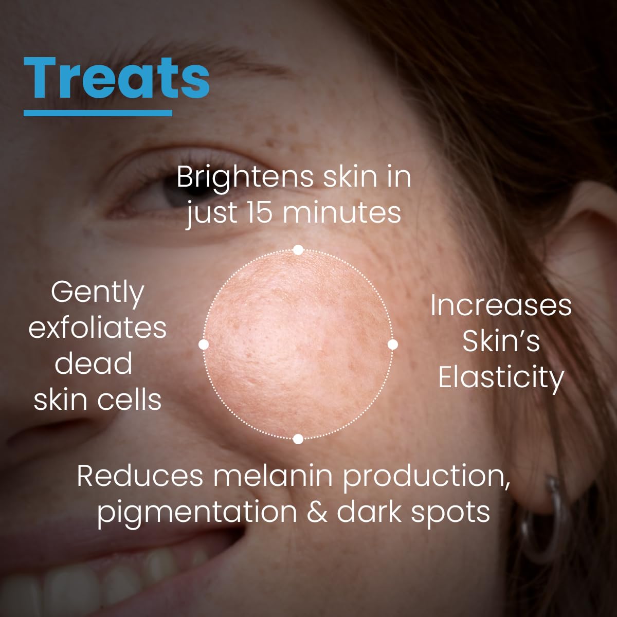 FCL Brightening Face Mask | Kojic Acid Face Mask With Hyaluronic Acid For Glowing Skin | With PHA, BHA & AHA | Exfoliates Dead Skin & Shrinks Open Pores - 100Gm