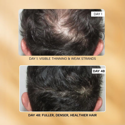 RAS Root-ine™ Hair Growth Serum with 19.5% Scalp Actives | Redensyl & Anagain | Promotes Hair Growth, Stimulates Hair Follicles & Regrowth | Controls Hair Fall & Increases Hair Density | Hair Growth Serum for Women & Men