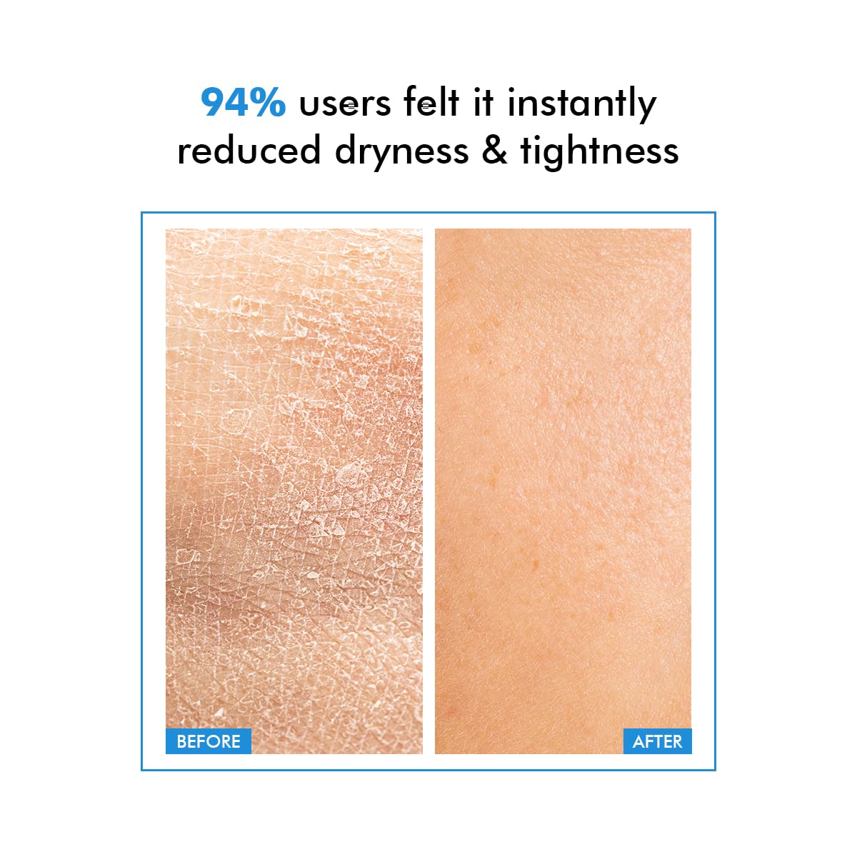 Before and after comparison of skin dryness with text indicating user feedback.