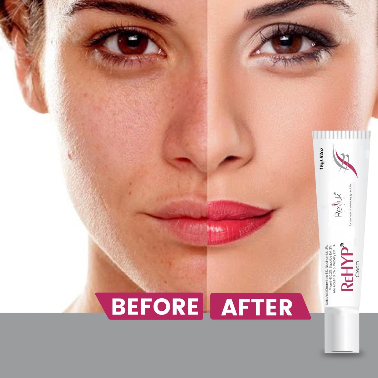 Rehyp Pigmentation Cream for Women – Dark Spot Remover, Brightening Face Cream with Kojic Acid & Alpha Arbutin – Paraben-Free, Dermatologically Tested – 15g