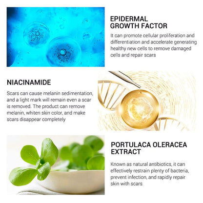 CLUB BOLLYWOOD® Removal Scar Cream Face Pimples Scar Stretch Marks Removal Acne Treatment | Bath & Body | Scar & Stretch Mark Reducers