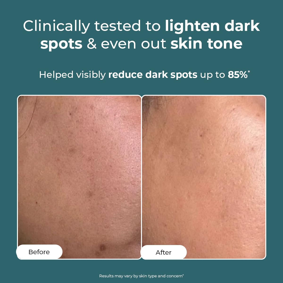 Before and after skin comparison with text claiming clinical testing for dark spot reduction.