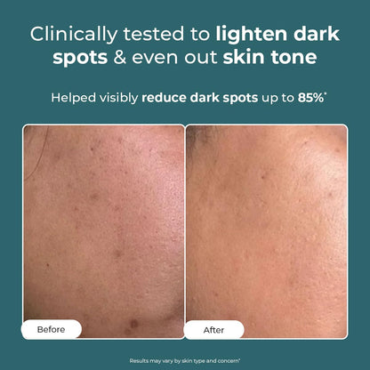 Before and after skin comparison with text claiming clinical testing for dark spot reduction.