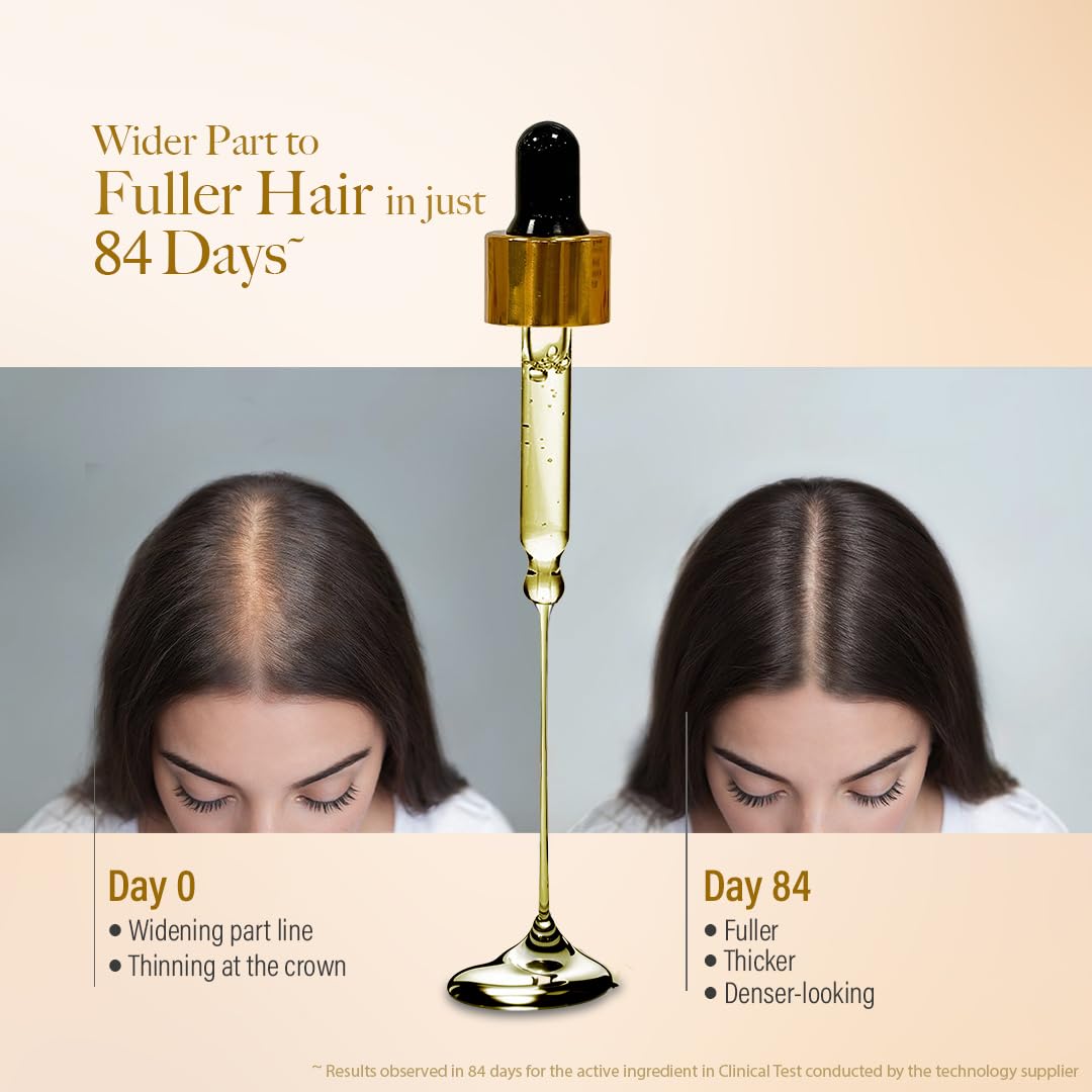 Kesh King Gold Advanced Hair Growth Serum – 21% Growth Actives with 3% Redensyl, 3% Anagain, Procapil, Kopexil Aqua & Ayurvedic Herbs | Visible Regrowth & Hair Fall Control | Women & Men | 30ml